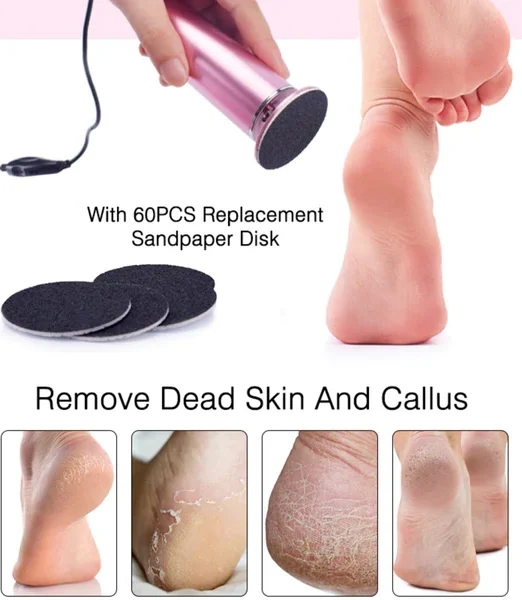 Electric Foot Callus Remover